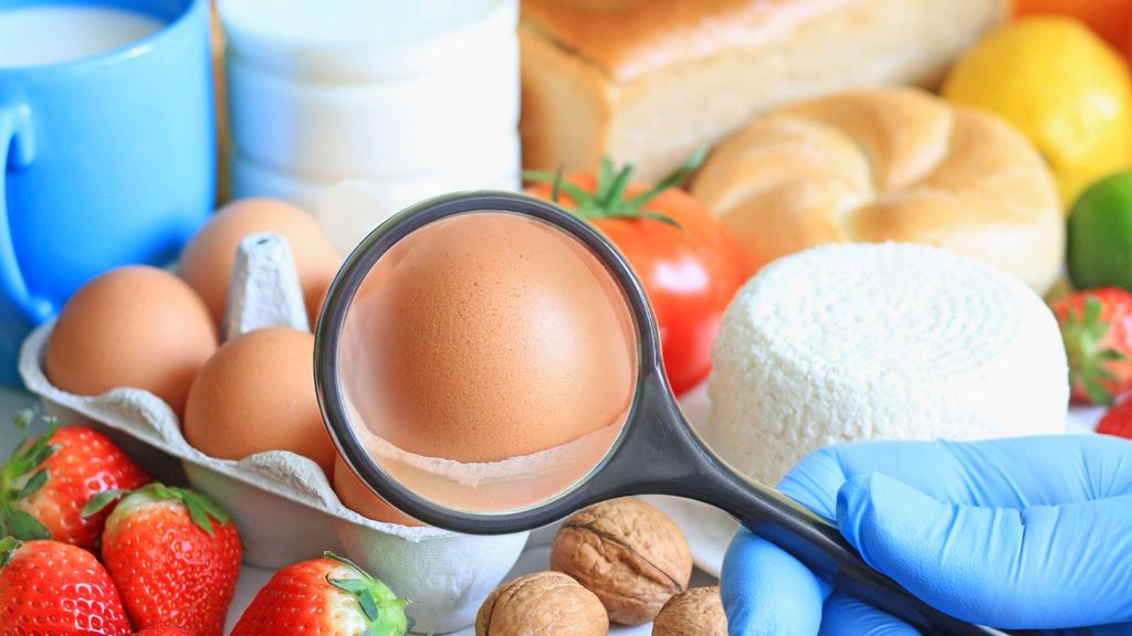 Mitkä ovat elintarviketurvallisuusjärjestelmän (FSS) etiketin edut?