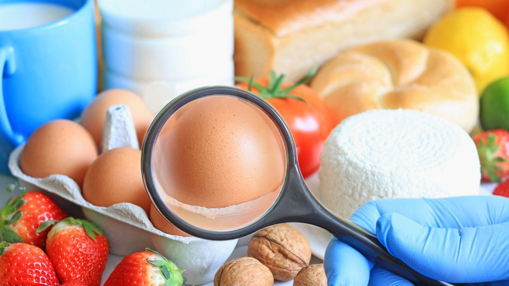 Gıda Güvenliği Sistemi (FSS) Etiketinin Avantajları Nelerdir?